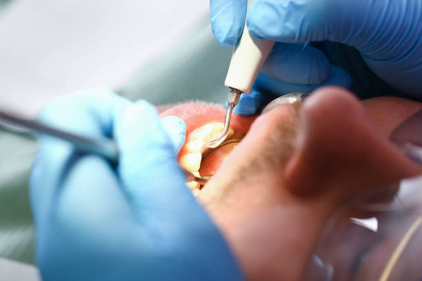 Best Emergency Gum Treatment in Islandia, NY